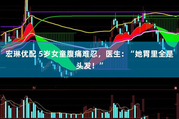 宏琳优配 5岁女童腹痛难忍，医生：“她胃里全是头发！”